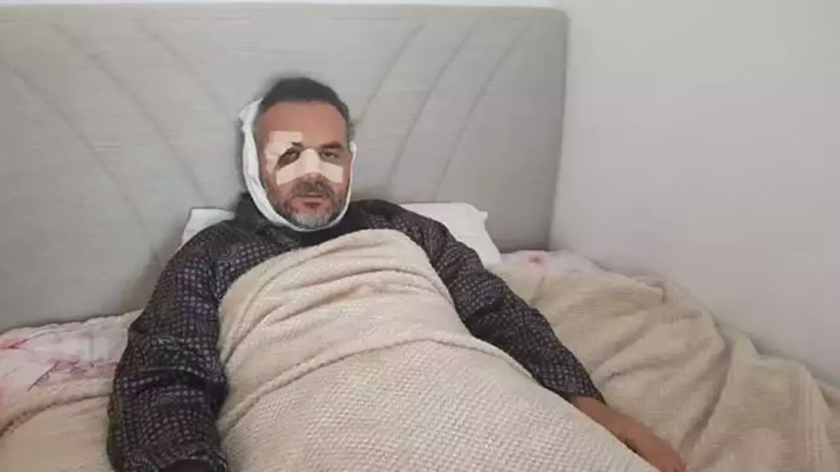 🔴 Rize'deki Burger King işletmesinin sahipleri, kendilerine tepki gösterdiği için dövdükleri Dr. Kemal Sağlam hakkında akla zarar açıklamalar yaptı:

Bizi provoke etmeye çalışan kişi Fransız marka bir araçla iş yerimizin önüne geldi. 

Açılışımızda kafasına sardığı bezle (kefiye