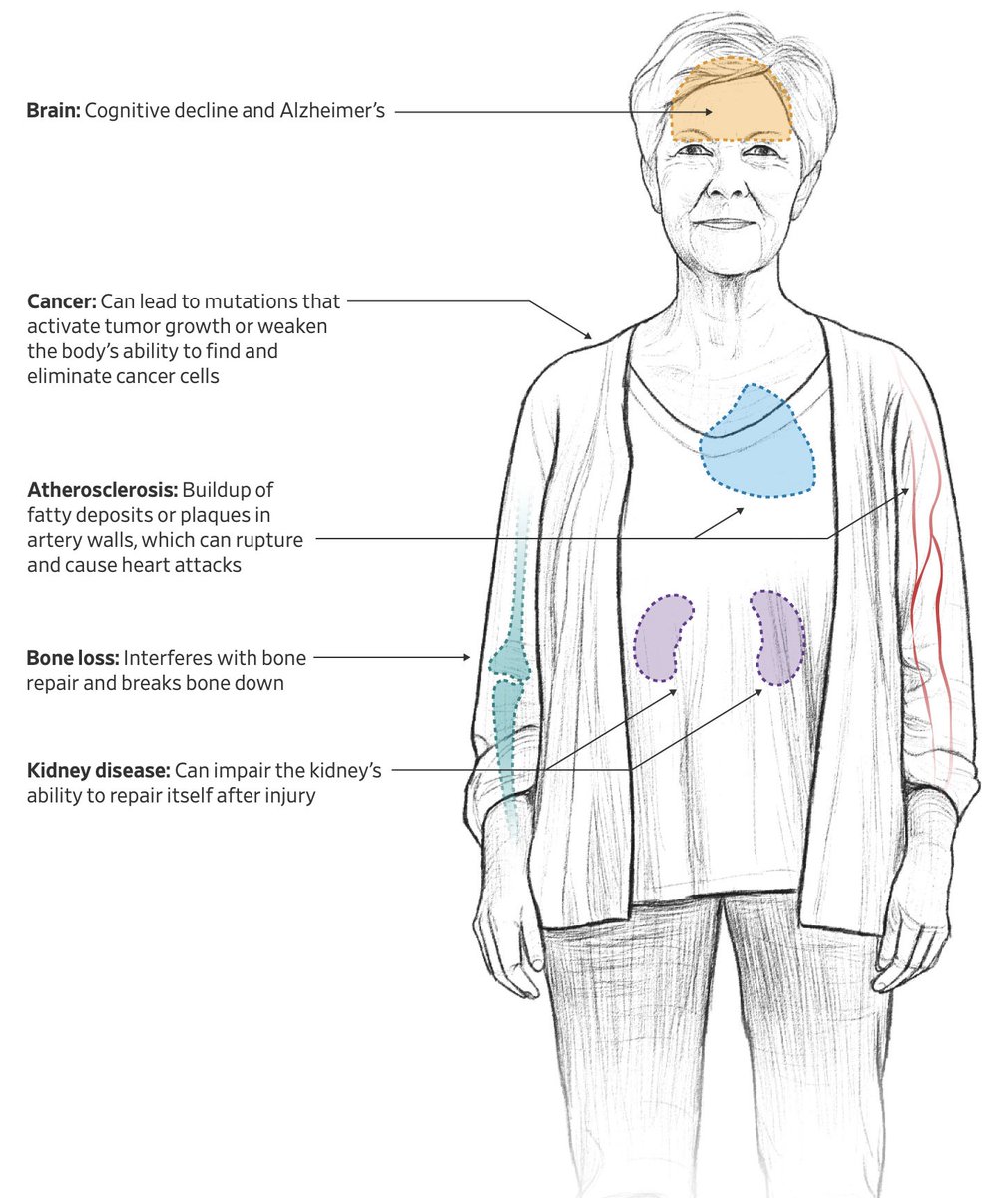 Eric Topol (@erictopol) on Twitter photo Chronic inflammation with agingāinflammagingā is a risk factor for age-related diseases. We're not doing enough to test for it or suppress it.
wsj.com/health/wellnesā¦
by <a href="/AlexLJanin/">Alex Janin</a> <a href="/betswrites/">Betsy McKay</a> Chronic inflammation with agingāinflammagingā is a risk factor for age-related diseases. We're not doing enough to test for it or suppress it.
wsj.com/health/wellnesā¦
by <a href="/AlexLJanin/">Alex Janin</a> <a href="/betswrites/">Betsy McKay</a>