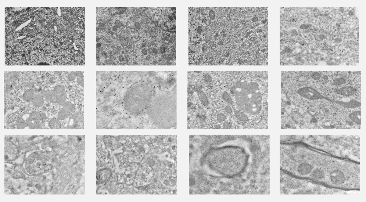 Friedman Brain Institute tweet media