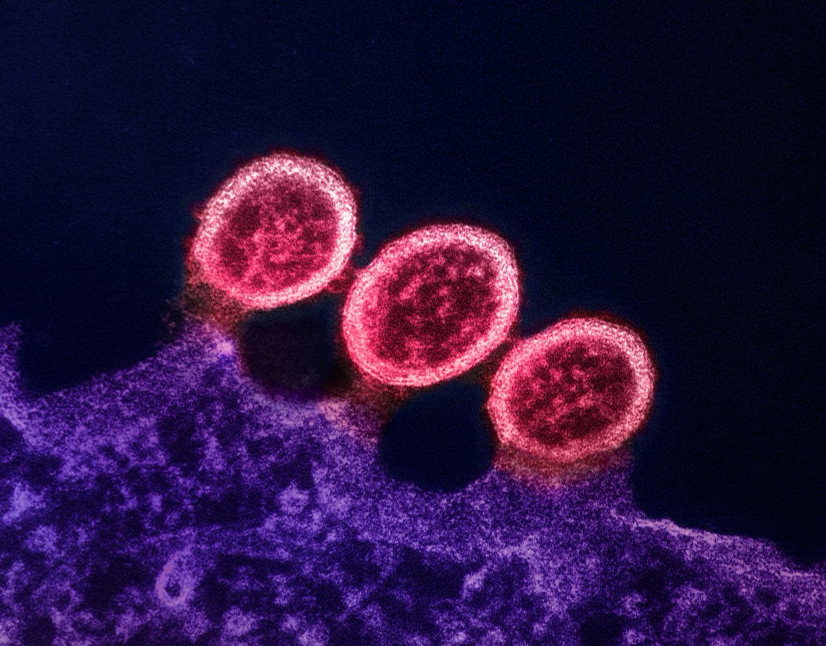 New #NIAID-supported science presented at the #HIVR4P2024 conference features a breadth of #HIV discovery and translational findings and enriches the evidence base on HIV prevention within the context of reproductive health. Learn more: go.nih.gov/jPCBv0l