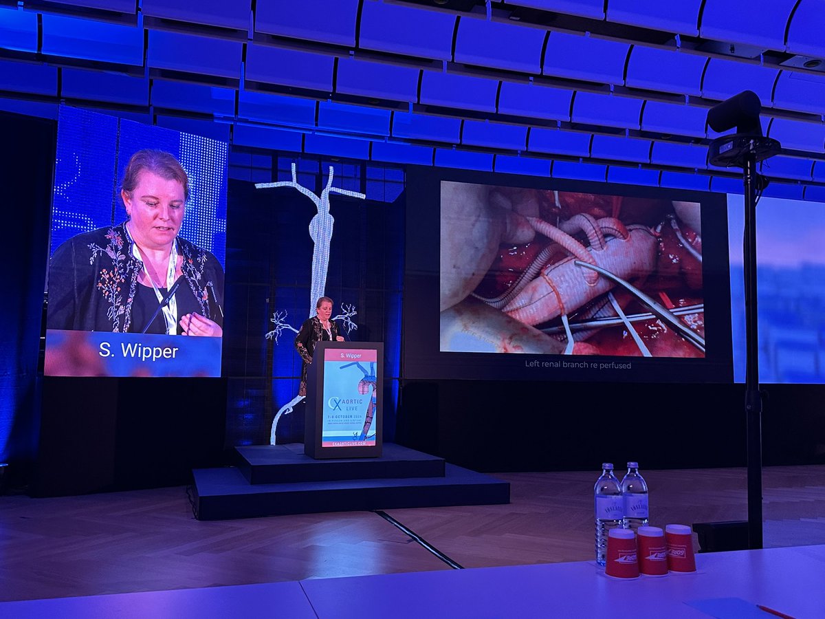 Aung Oo (@mraungoo) on Twitter photo Professor Sabine Whipper presented recent Thoracoflo case to demonstrate the technique in CX Vienna Aortic Live 2024. Future is bright for CTD patients with TAAA. <a href="/BartsAorta/">Barts Aortic Surgery</a> <a href="/TerumoAortic/">Terumo Aortic</a> <a href="/AortaEd/">AortaEd</a> Professor Sabine Whipper presented recent Thoracoflo case to demonstrate the technique in CX Vienna Aortic Live 2024. Future is bright for CTD patients with TAAA. <a href="/BartsAorta/">Barts Aortic Surgery</a> <a href="/TerumoAortic/">Terumo Aortic</a> <a href="/AortaEd/">AortaEd</a>