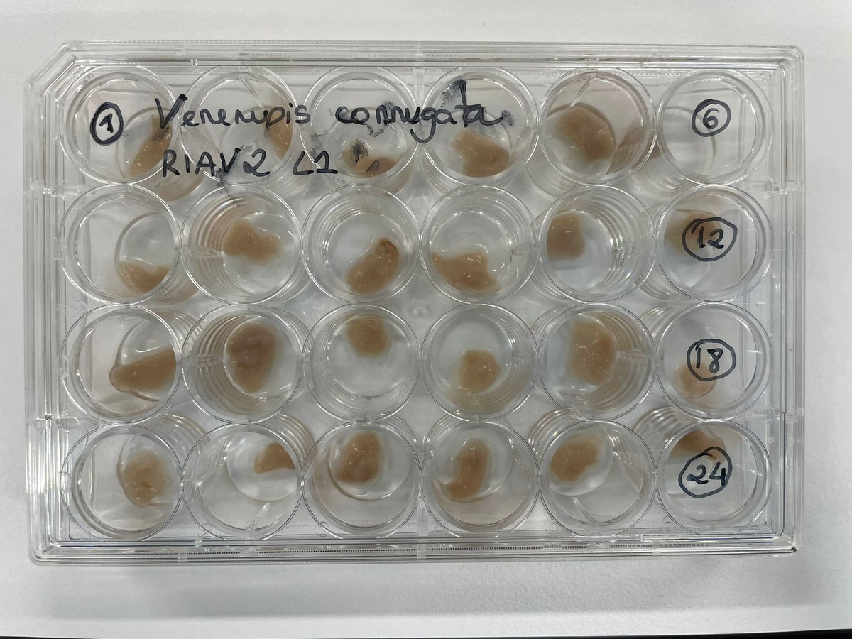 UNTIE__project's tweet image. Over the last week, we&apos;ve been dissecting several bivalves from the Ria de Aveiro, including: #Cerastodermaedule, #Venerupiscorrugata and #Venerupisphilippinarum 🦪 for RFTM and parasite prevalence to provide a global approach to the health 🏥 of bivalves in the #RiadeAveiro🌊