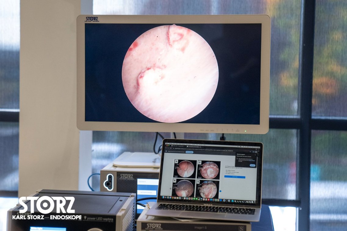 ST3 Urology Trainees are getting familiar with our bipolar resectoscopes and refining their technical skills in TURBT, or Transurethral Resection of Bladder Tumours, at this year’s Urology Simulation Boot Camp (<a href="/UrologyBootCamp/">Urology Boot</a>). Attendees are making their way through 10