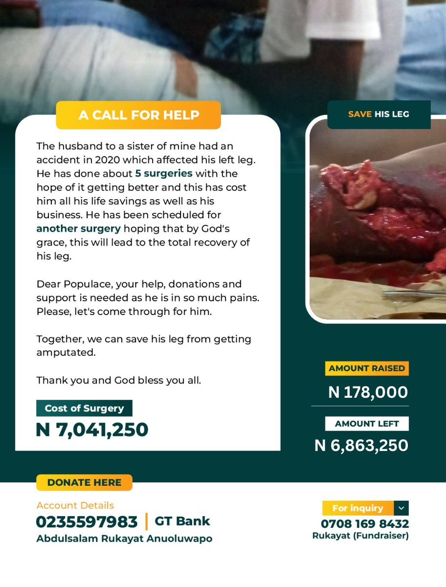 FausiyatOlolade's tweet photo. Together, we can save his leg from getting amputated.π
Account Number: 0235597983
Account Name: Abdulsalam Rukayat Anuoluwapo
Bank Name: GT Bank
Contact: 08161728173
Thank you and God bless you all.
#ACallForHelp #TogetherWeCan
#LetsMakeHimLiveAgain
#HisLiveCounts
#Help https://t.co/KNRHoIQBzV