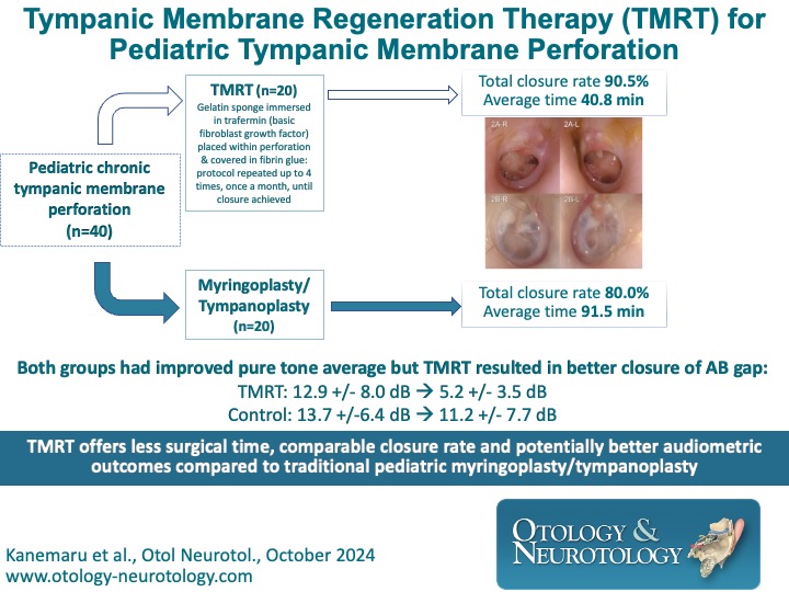 Tympanic membrane regeneration therapy with trafermin results in a high closure rate and improved hearing outcomes, comparable if not superior to traditional #Myringoplasty &amp; #Tympanoplasty techniques. #Otology #TMPerforation ow.ly/1WYk50TFbM4