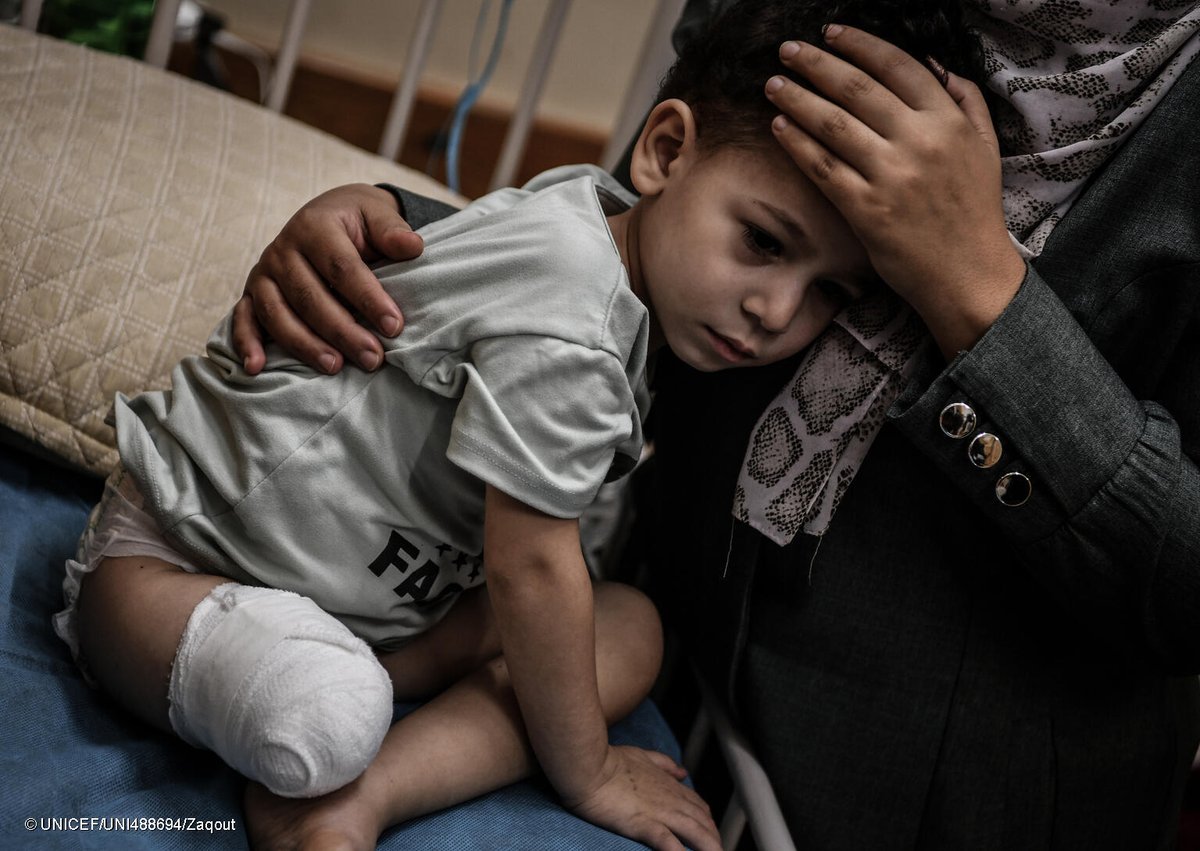Ahmad’s home in central Gaza was bombed in Oct 2023, leading to the amputation of his leg

A year later, 14000 children in Gaza and the West Bank reported killed, thousands more injured &amp; all live in fear &amp; terrible conditions

Children are not targets. They need a ceasefire now.