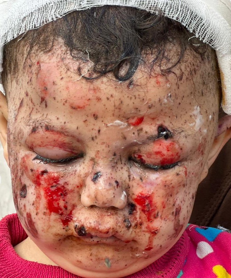 nexarfer's tweet photo. @RoxanaDuchen Degenerado es no decir nada sobre este genocidio... https://t.co/WbEiXZ7JEe