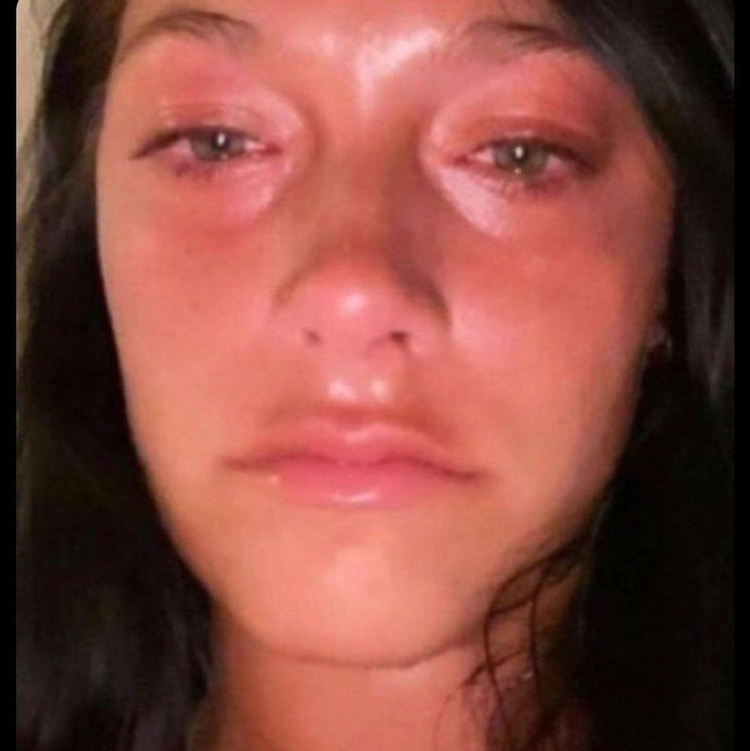Yo cuando mi ojo de loca no se equivoco y quería que se equivoque