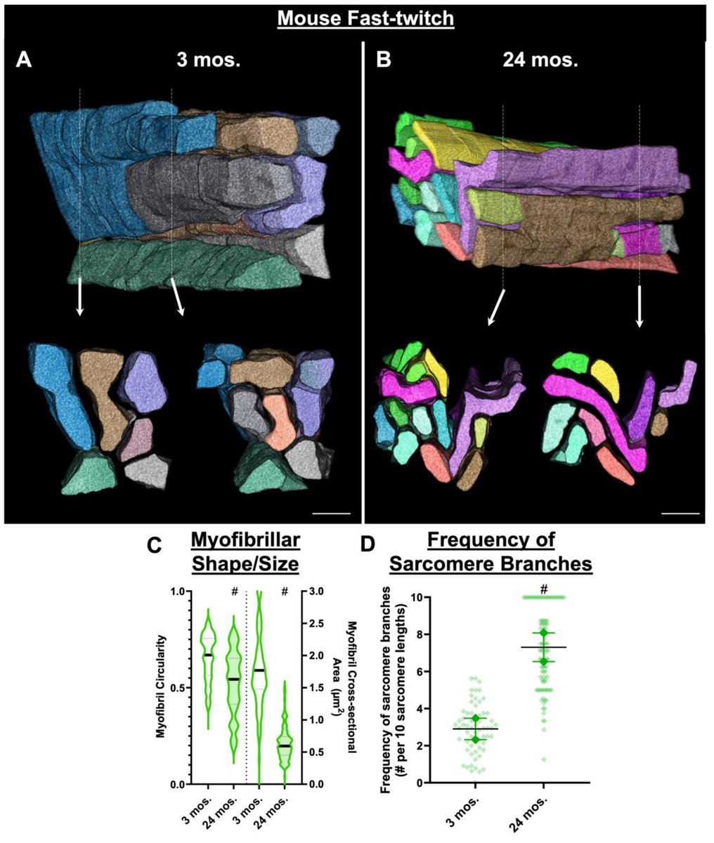 Uri Manor 💔 (@manorlaboratory) on Twitter photo <a href="/AtHinton/">Hinton Laboratory at Vanderbilt</a> just dropped a beautiful new paper with amazing serial blockface SEM imaging of aging muscle tissues 🙌🙌🙌
biorxiv.org/content/10.110… <a href="/AtHinton/">Hinton Laboratory at Vanderbilt</a> just dropped a beautiful new paper with amazing serial blockface SEM imaging of aging muscle tissues 🙌🙌🙌
biorxiv.org/content/10.110…