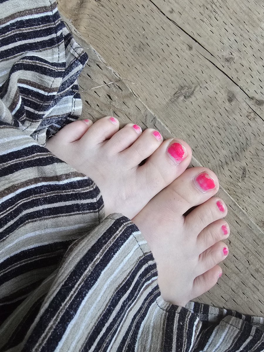 BaeornR's tweet photo. I really need a pedicure before I go on vacation next week.... my feet look so banged up right now https://t.co/37dZ5Mpie1