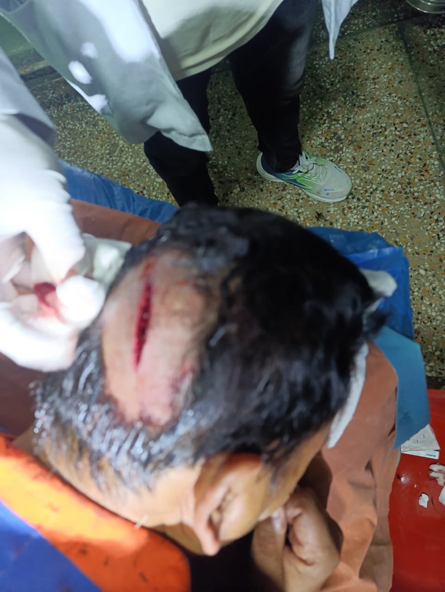 realpbhattarai's tweet photo. हिजो राती करिव ९ बजे आदरणीय मित्र पुण्य गौतममाथि केहि अपराधीक समुहले ज्यान लिनेगरि आक्रमण गरेका छ्न !  उहाको अहिले नेपाल मेडिकल कलेज जोरपाटीमा ICU मा राखेर उपचार हुदै !  टाउकोमा गहिरो चोट लागेको छ!  निधारमा हड्डीहरू भुटेका छ्न उहाको स्वास्थलाभको कामना गर्दछु साथै आक्रमण कारी तुरुन्त पक्राउ गरि कार्वहि गर्न अनुरोध गर्दछु !  @kpsharmaoli @bpaudel1959  @NepalPoliceHQ