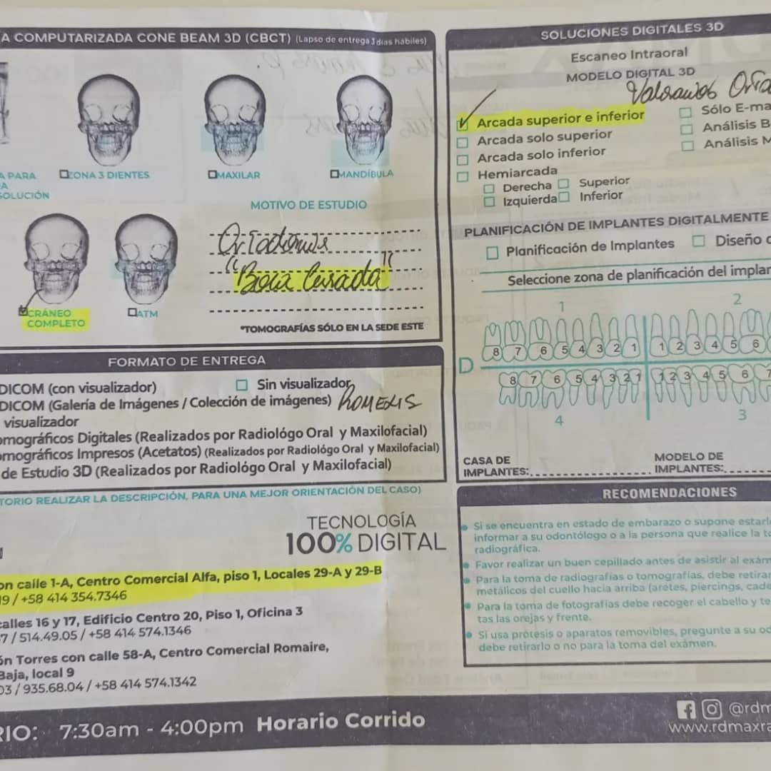 AlexaGomezDos's tweet photo. Buenas noches. Muchos recordarán a Óscar Navarrete, uno de los muchachos heridos en las protestas del 2017. Óscar necesita realizarse unos exámenes para poder realizarse una cirugía maxilofacial que le ayude en su proceso de volver a hablar. Todas estas son secuelas de la bomba que le impactó en su pecho. Su mamá @CarmenEliRuiz , está realizando una rifa para lograr el monto. Sorteo para estudio de tomografía y RX
Día del sorteo 15/10/2024.
1er premio $30
2do premio $20
3er Premio $10
Costo Bs.40 

Muchas gracias de antemano a todos los que puedan colaborar  🙏🏼♥️