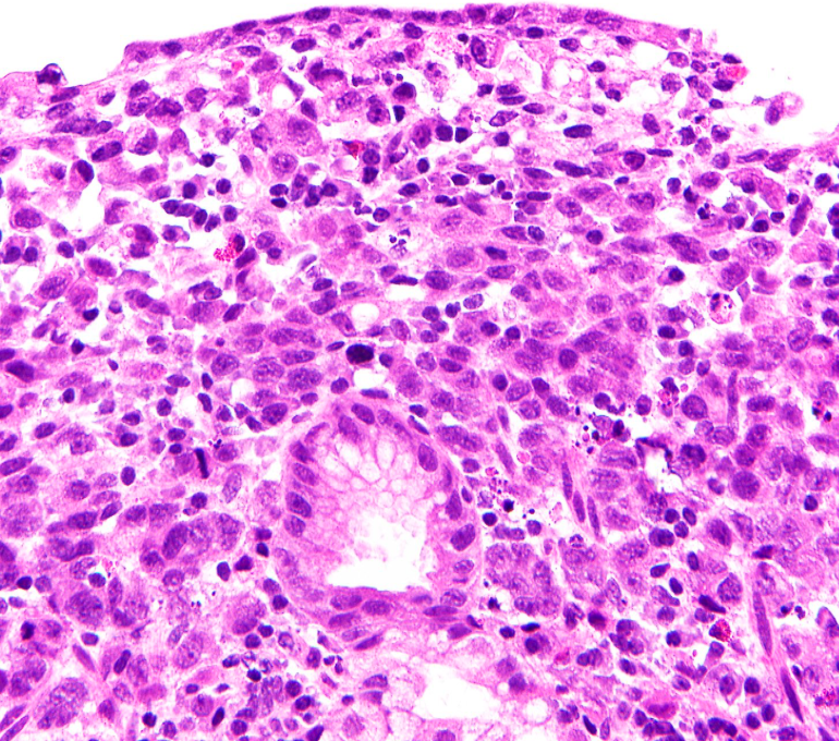 Gunt A.B tweet media