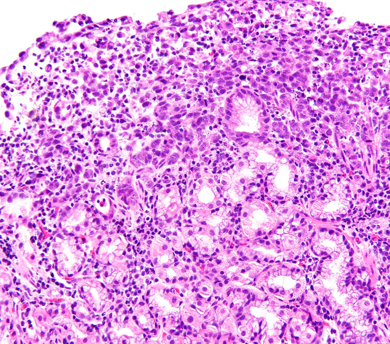 Gunt A.B tweet media