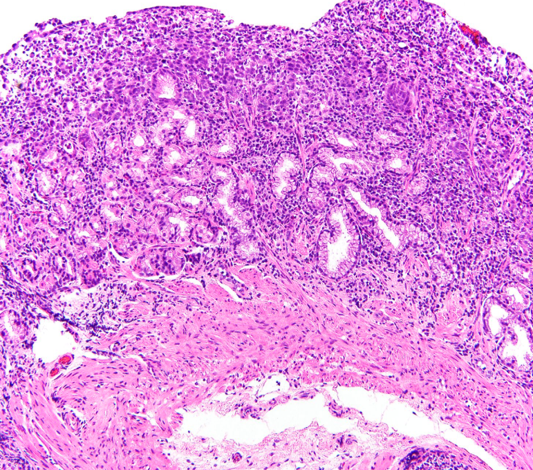 Gunt A.B tweet media