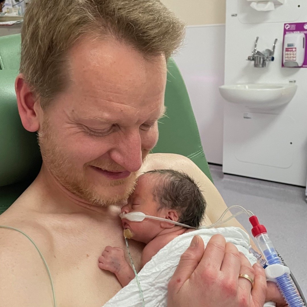 ImperialNHS's tweet photo. Clara was safely delivered at St Mary’s Hospital by emergency C-section at 31 weeks and 6 days, weighing 1.7kg. She had to spend a total of 27 days in our neonatal intensive care unit where she was born so early. 

Clara has now been home for three months 💙

1/2 https://t.co/mOFgTuuxZZ