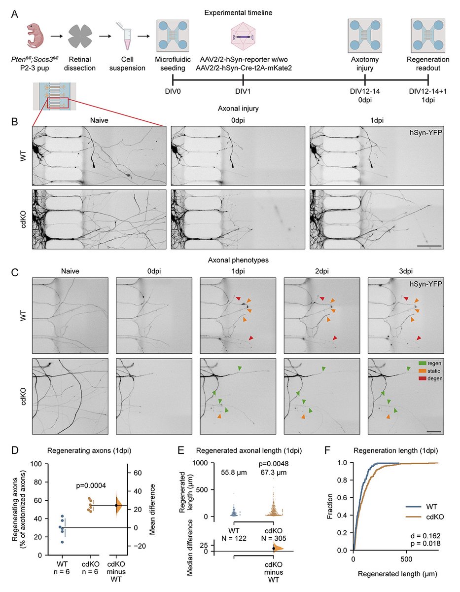Journal of Cell Biology (@jcellbiol) on Twitter photo Local #glycolysis supports injury-induced axonal regeneration, say Luca Masin <a href="/LucaMasin/">Luca Masin</a>, <a href="/StevenBergmans/">Steven Bergmans</a>, <a href="/vandyckannelies/">Annelies Van Dyck</a>, @FarrowLab, <a href="/GroefLies/">Lies De Groef</a>, and Lieve Moons <a href="/LabMoons/">MoonsLab</a> <a href="/KU_Leuven/">KU Leuven</a>: hubs.la/Q02RGSsJ0
#Metabolism #CellMetabolism #Neuroscience Local #glycolysis supports injury-induced axonal regeneration, say Luca Masin <a href="/LucaMasin/">Luca Masin</a>, <a href="/StevenBergmans/">Steven Bergmans</a>, <a href="/vandyckannelies/">Annelies Van Dyck</a>, @FarrowLab, <a href="/GroefLies/">Lies De Groef</a>, and Lieve Moons <a href="/LabMoons/">MoonsLab</a> <a href="/KU_Leuven/">KU Leuven</a>: hubs.la/Q02RGSsJ0
#Metabolism #CellMetabolism #Neuroscience