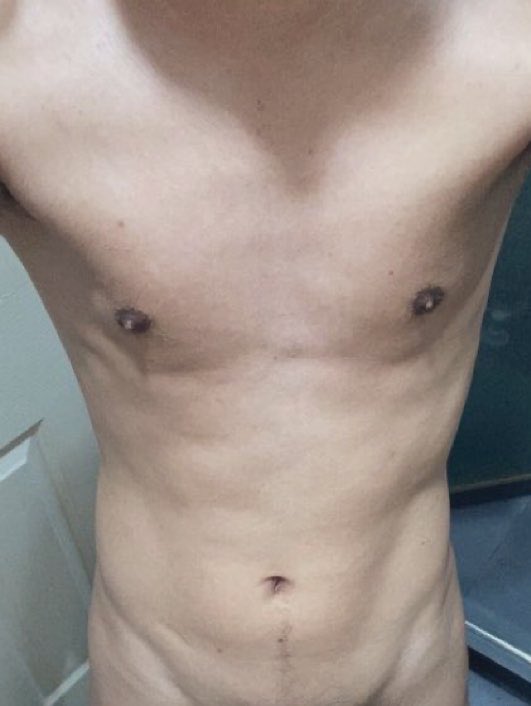 ไม่เป็นสเปคของใครสักคนบ้างเลยหรอ 🥺
#เรียลชาย #เรียลชายเดี่ยว #เรียลทำงาน #fwbกรุงเทพ #fwbกทม #Skinship #นัดกอด #นัดกอดกทม #นัดกอดไม่สอดใส่ #นัดลับๆ #หาเพื่อนคุย #หาคนคุย #เมคเฟรน #imgxforลั่น #imgforsex