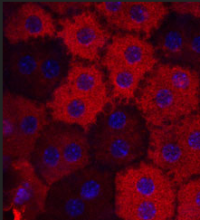 NatEyeInstitute's tweet image. It’s our October #ImageOfTheMonth! This photo features retinal pigment epithelial cells stained red by RPE65 antibody. RPE65 gene mutations can cause a form of Leber congenital amaurosis (LCA), a disease that leads to visual impairment early in childhood. bit.ly/3YeJnFi