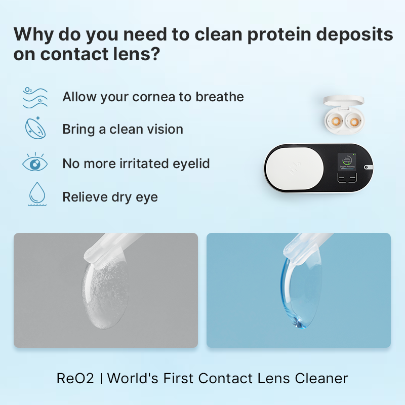 3NEyecare's tweet photo. When cleaning your contact lenses🫧, make sure to remove those stubborn protein deposits. https://t.co/StvVa3q7UO