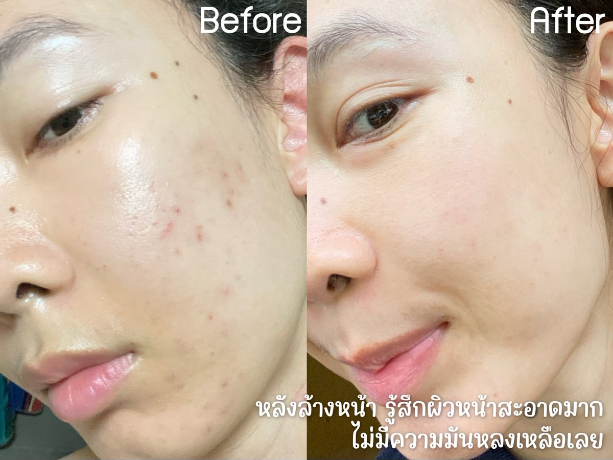 ❗️ใครไป 7-11 แนะนำ🍅ซื้อสบู่มะเขือเทศของ #Smooto ติดมือด่วนๆ ใช้ดีมากกกแม่!! นางมีคอลลาเจน ฟื้นฟูผิวหมองคล้ำ ให้กระจ่างใส เรียบเนียน นุ่มขึ้น ลดรอยด่างดำได้ดีมากก หลังล้างฟีลหน้าสะอาดสุดๆ🫧 ใช้ได้ทั้งผิวหน้า ผิวกาย ชอบสุดที่แถมตาข่ายตีฟองให้ด้วย แล้วในราคา 59 บาท อะแม่ เริ่ดดด!!
 #สบู่เซรั่มมะเขือเทศสมูทโตะ #สมูทโตะ #หน้าใสไวเวอร์