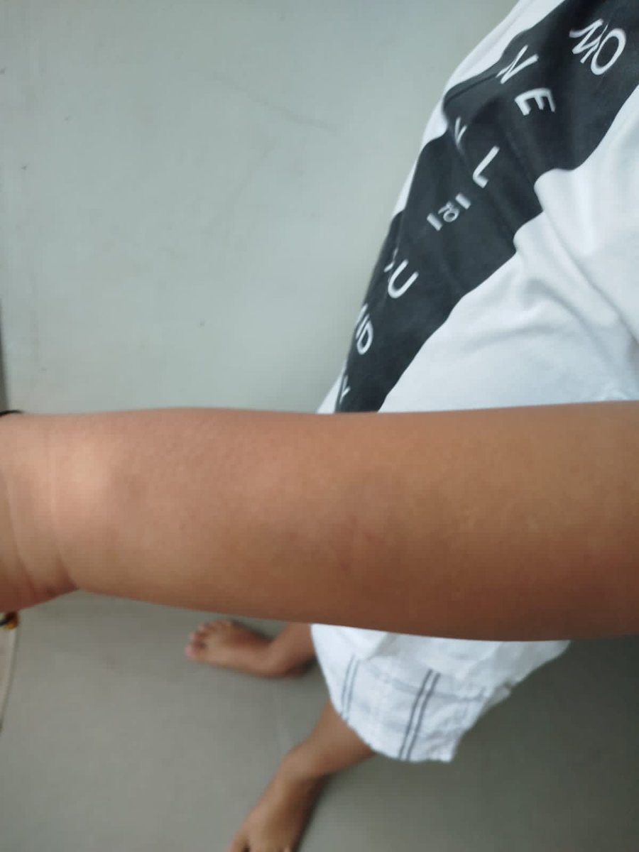 vicandsan_'s tweet photo. PERUNDUNGAN ANAK DI LINGKUNGAN SEKOLAH KOTA BOGOR - SDN CIBULUH 1

ponakan gue jd korban perundungan untuk yang KEDUA KALI dengan PELAKU YANG SAMA. tidak ada penanganan serius dari pihak sekolah dari kejadian pertama.

mohon atensinya @PemkotaBogor @txtdaribogor https://t.co/PtM5bsxWVB