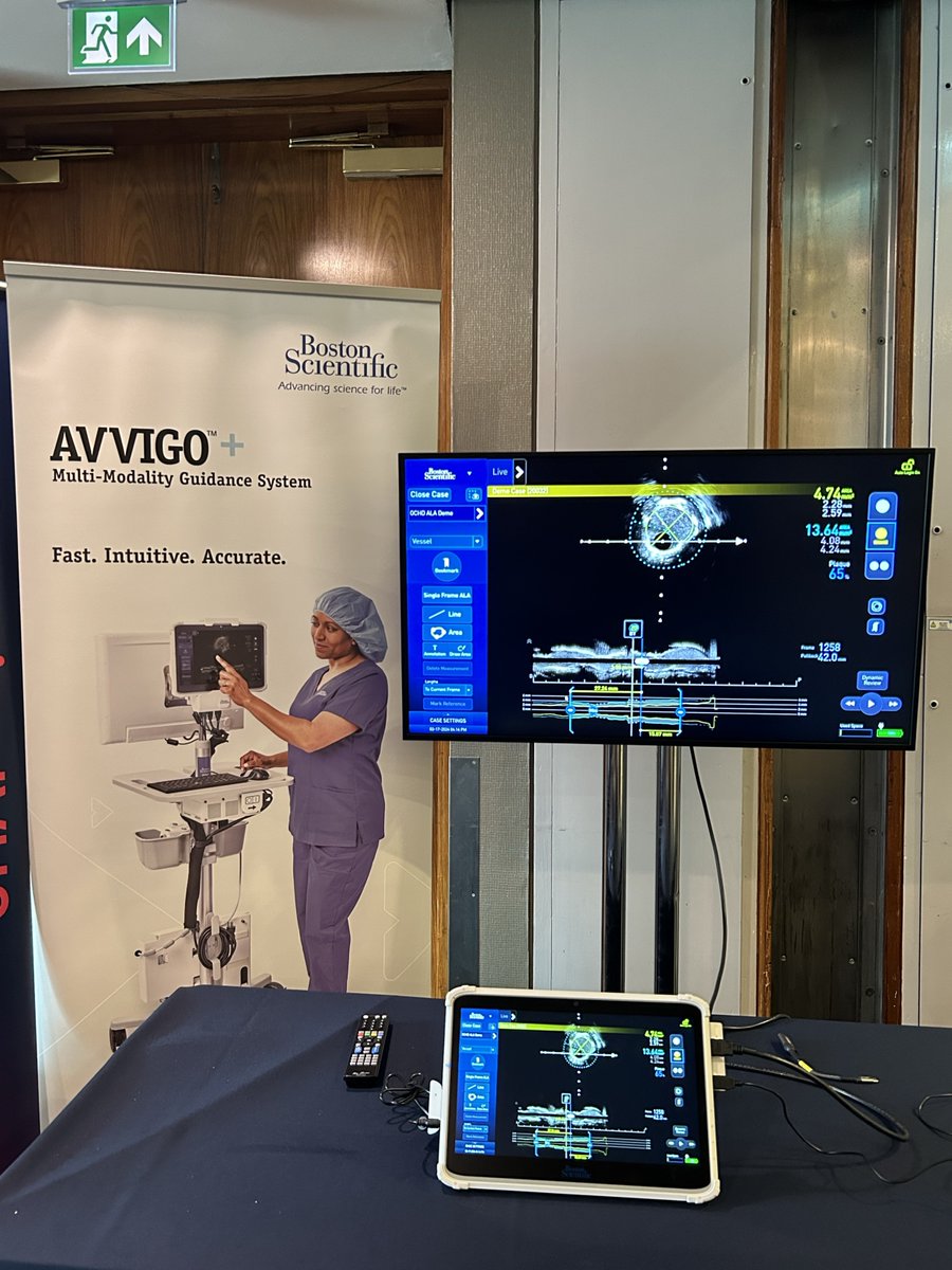 BSC_EU_Heart's tweet image. AVVIGO+™ at #Optima!
Explore AVVIGO+ offering real-time insights for optimised complex PCI. Ease clinical decision-making with AI ALA and Fast pull back capabilities — all in one streamlined system.
Discover more at Innovation Alley: bostonsci.co/IUW5v3CCwNb

#IVUS123 #ComplexPCI