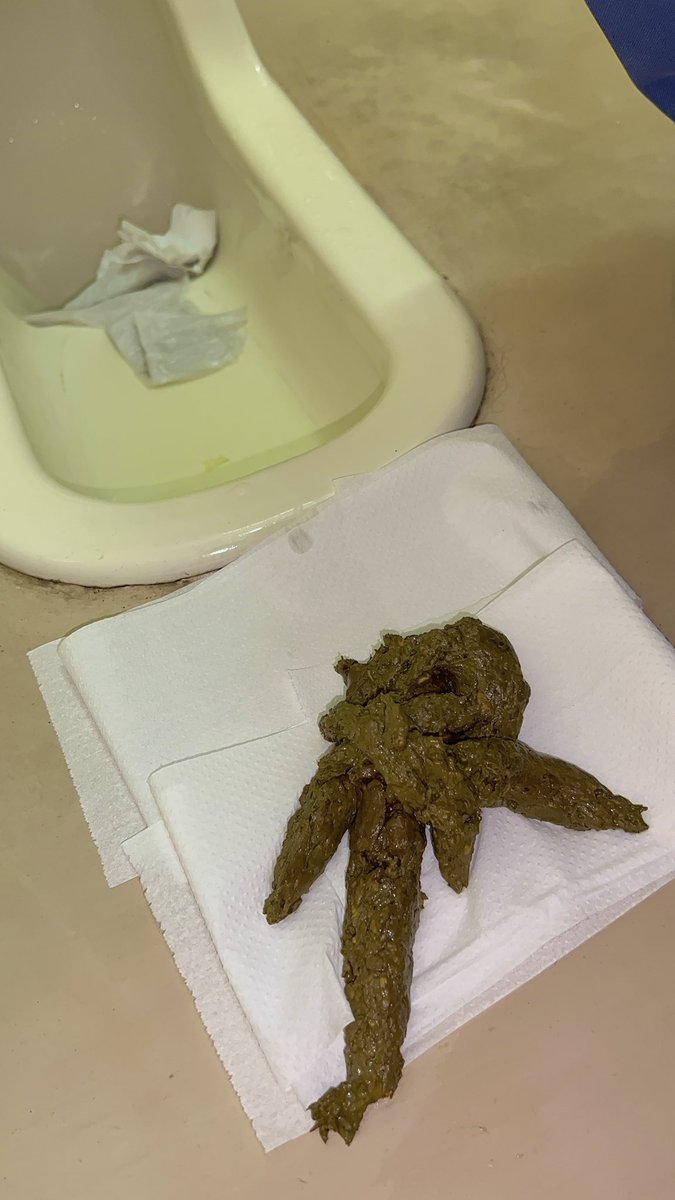 Me531975's tweet photo. 今日出たうんちだよ💩
沢山でたのに載せるの忘れてた!😮 https://t.co/Z1zVfizeB2