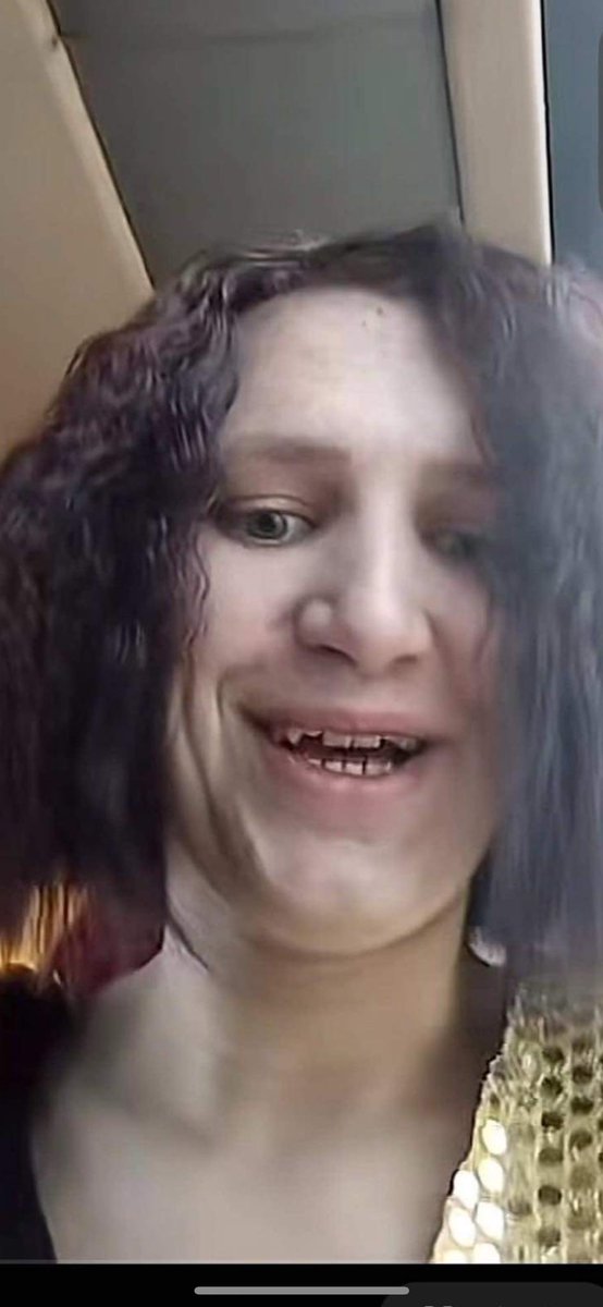 Mida mu tupsukarp naeb kui ma ta lahti teen