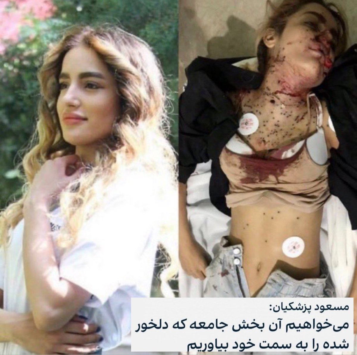 its__violet_'s tweet photo. حدیث جان پاشو 
فقط ۶تا گلوله جنگی بوده دیگه
میگن دیگه دلخور نباشیم….
#حدیث_نجفی 
#از_شما_تنفر_داریم https://t.co/EkWEUKwQbY