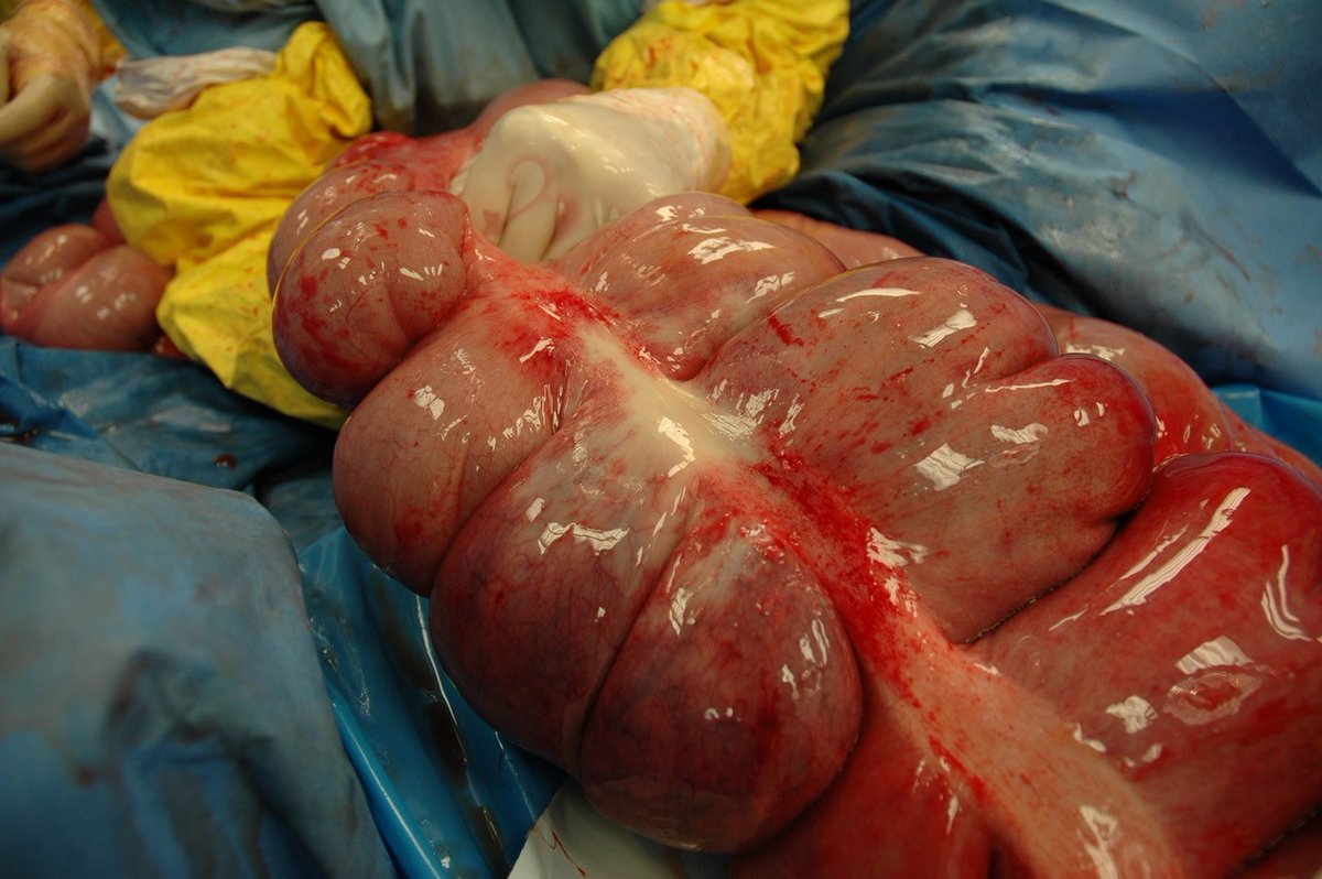 The latest special issue of EVJ showcases the advantages of a multi-disciplinary management of cases, with a collect of articles on topics related to soft tissue surgery.

Read more and access the special issue - beva.org.uk/News/Latest-Ne…