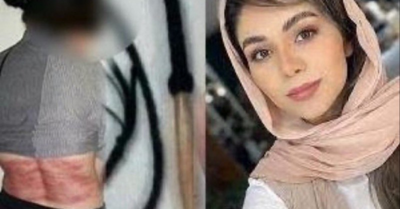 🚨Roya Heshmati, an Iranian woman, was lashed 74 times for refusing to wear hijab!🚨

Her defiance against Iran's oppressive hijab laws, even in the face of brutal punishment, fuels our resolve. We will not stop until no woman in Iran faces such cruelty