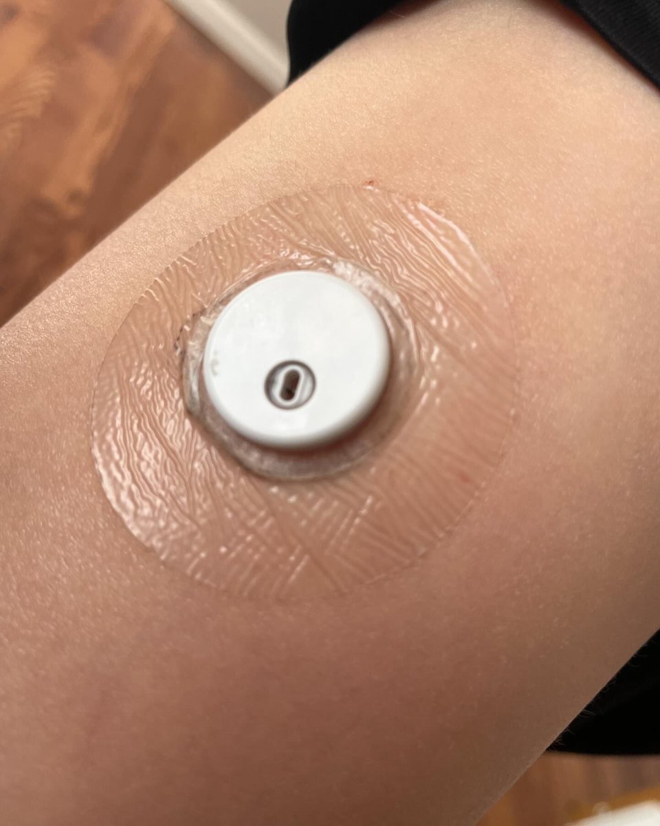 LexcamMD's tweet image. Lexcam Patches for Libre 3 shoplexcam.com
#typeonestrong #typeonelookslikeme #teamfreestylelibre #freestylelibre3 #diabetes1 #t1warrior #cgm #type1warrior#type1diabetics  #t1dlife #t1dcommunity #freestylelibreabbott #freestylelibresensor #typeonediabetic