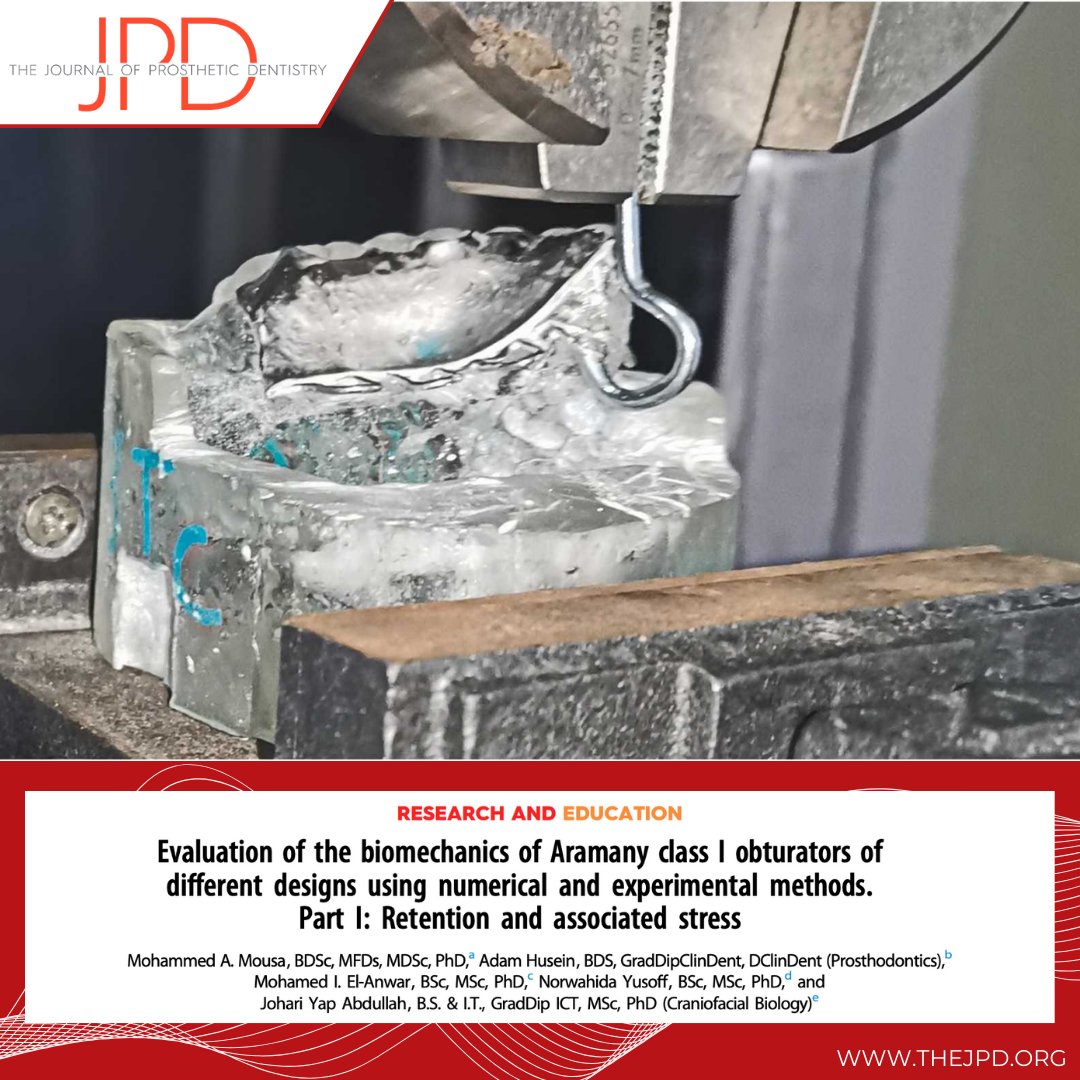 JPDentistry's tweet image. This article compares the retention, displacement, and stress distribution of a tripodal vs. linear #obturator framework designs rehabilitating #hemimaxillectomy defects using physical biomechanical testing and #finiteelementanalysis: thejpd.org/article/S0022-…