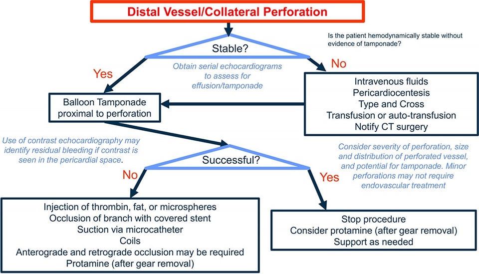 🔴Management of PCI Complications⤵️ #Review #openaccess 

🔹ahajournals.org/doi/10.1161/CI…
 #Cardiology #FOAMed #MedEd #medstudent #paramedic #Cardiology #CardioEd #ECG  #medtwitter #meded #CardioTwitter #cardiotwiteros  #MedX #cardiovascular #MedTwitter #medical #medEd
