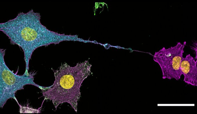 An image of cells, connected through a thin process