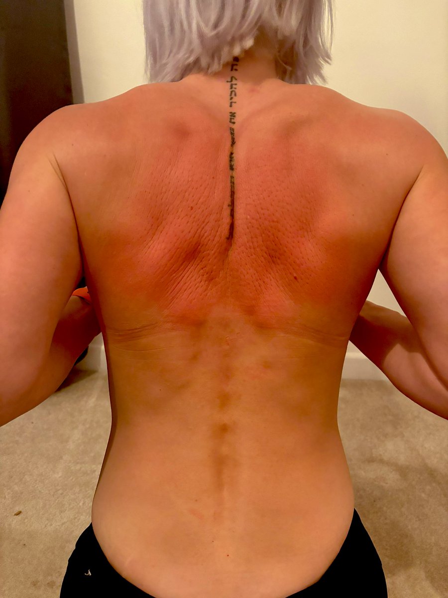 Wee_Welshie's tweet image. Sore, but the good kind. My back and shoulders are very much appreciative 👌
#acupressure #bedtimeroutine #SelfCare