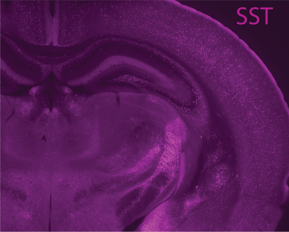 Ivan Alex Lazarte y Priela (@ivanalexlazarte) on Twitter photo Check out our poster A67 on cortical somatostatin interneurons of postnatal mice, from molecular to systems level, at #SfN24 tomorrow morning. This work is from the <a href="/Interneuron_Dev/">Butt Lab - Oxford</a> lab together with <a href="/ENtaouka/">Evgenia Ntaouka</a>, <a href="/antpcolorado/">Antonio Pérez-Colorado</a>, and Lynn Geyer in collaboration with <a href="/HjerlingLeffler/">Jens Hjerling Leffler ⭐️⭐️🇺🇦⬜️🟥⬜️</a>. Check out our poster A67 on cortical somatostatin interneurons of postnatal mice, from molecular to systems level, at #SfN24 tomorrow morning. This work is from the <a href="/Interneuron_Dev/">Butt Lab - Oxford</a> lab together with <a href="/ENtaouka/">Evgenia Ntaouka</a>, <a href="/antpcolorado/">Antonio Pérez-Colorado</a>, and Lynn Geyer in collaboration with <a href="/HjerlingLeffler/">Jens Hjerling Leffler ⭐️⭐️🇺🇦⬜️🟥⬜️</a>.