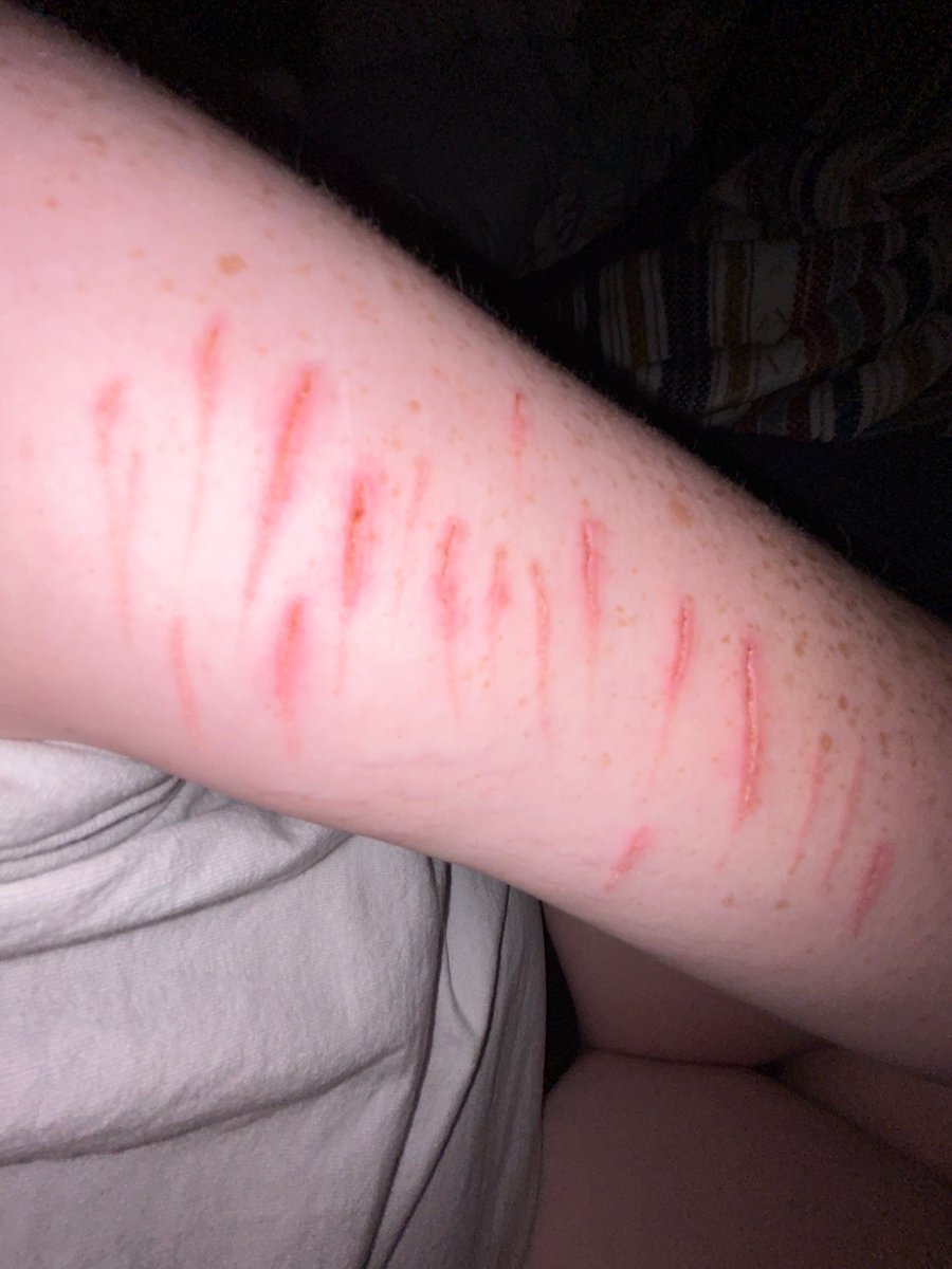 does the first one look infected…. gulp