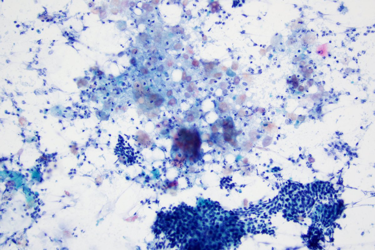 MHysek's tweet image. Is it too early to bring out the Halloween decoration? #twitterpath #cytology #youngEFCS