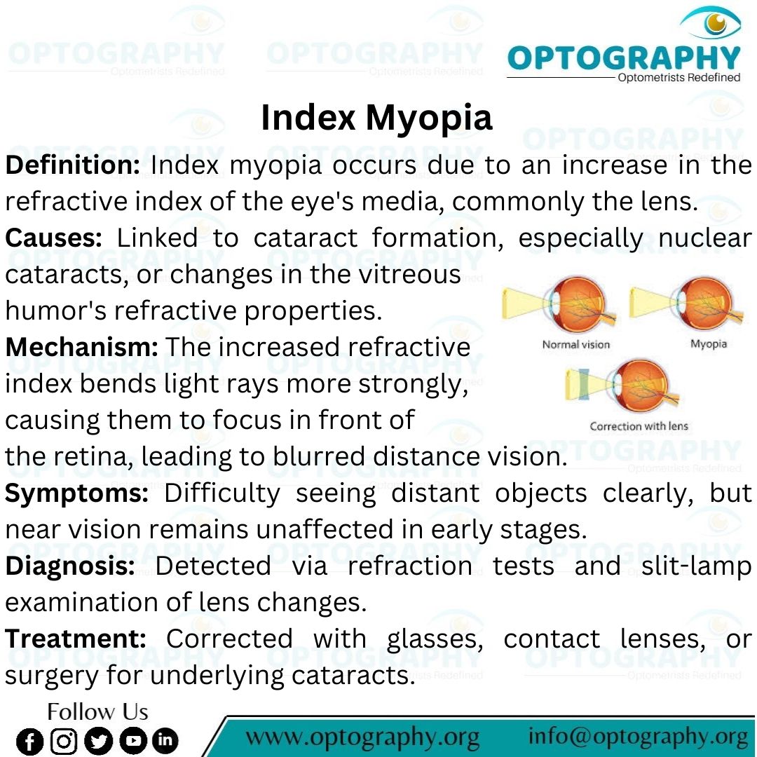 Optography8's tweet photo. Index myopia is more than just a refractive errorโit's a sign of deeper changes within the eye.
#IndexMyopia #EyeHealth #Optometry #VisionCare #EyeCare #RefractiveError #CataractAwareness #Optography #Thatoptometrist https://t.co/IuwodOjrbs