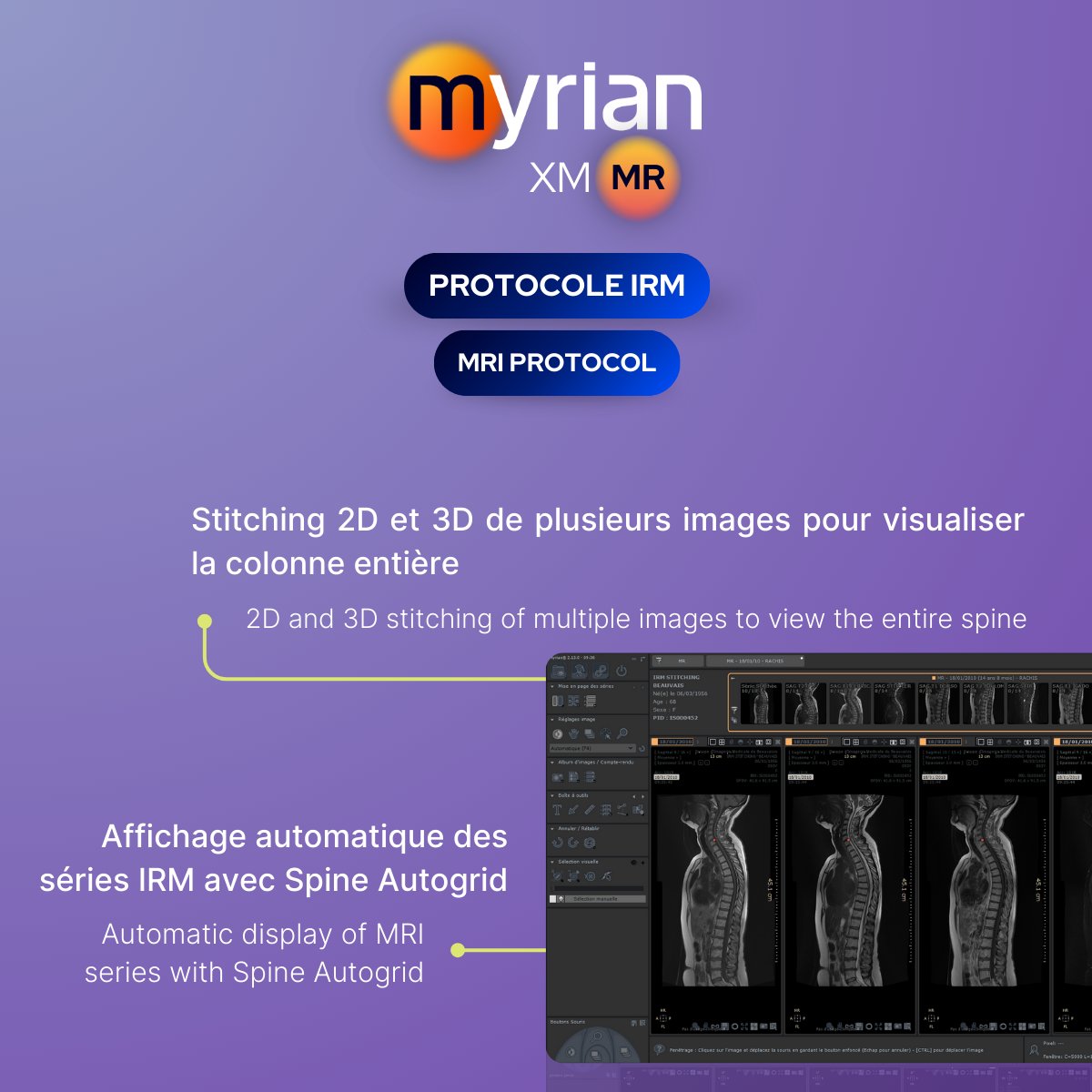 [Journée Mondiale]  de la colonne vertébrale 🦴

Afin d'accompagner au mieux le diagnostic et le suivi des maladies de la colonne, nous avons développé 🟠Myrian® XM-MR pour le rachis.

Découvrez nos fonctionnalités ⬇️