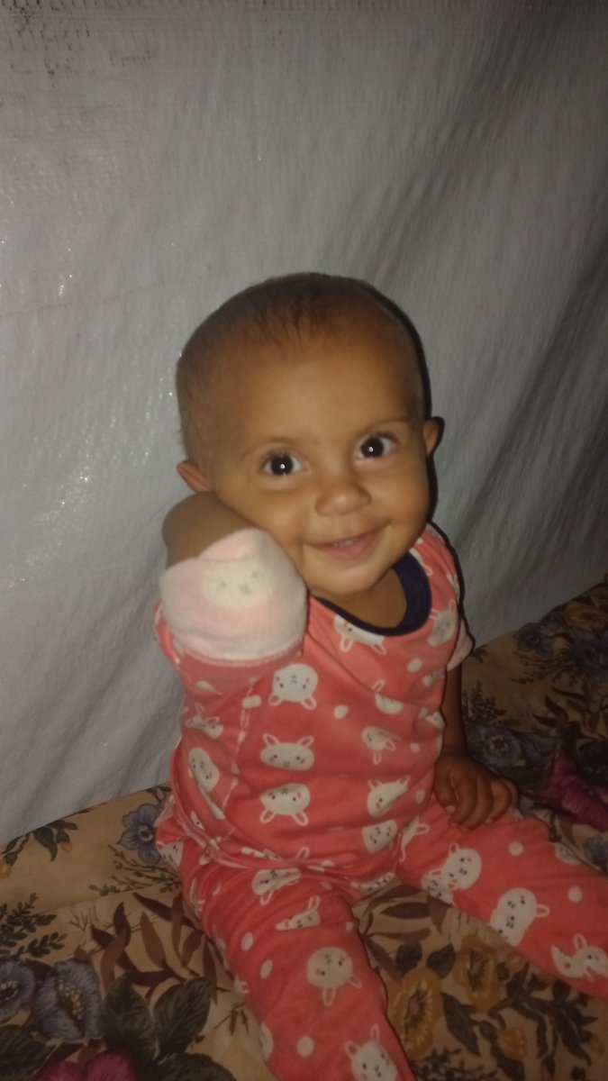 Unfortunately, donations are very low, and there is not much left for our goal. Please continue your support so that we can do it, look into this child's eyes, and think of her
gofund.me/02225758
