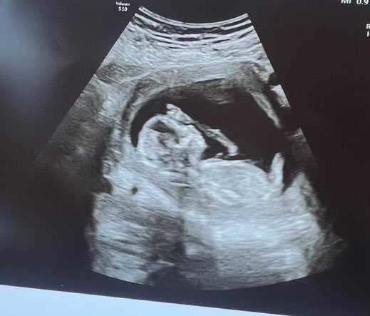 Had to wait for my son’s permission or he would’ve killed me….but….Why end my law enforcement career with <a href="/DallasPD/">Dallas Police Dept</a> now? Because when I got the special call, and then this shirt from my son and daughter in-law….Well, it was clear…..I knew I had reached my highest rank..