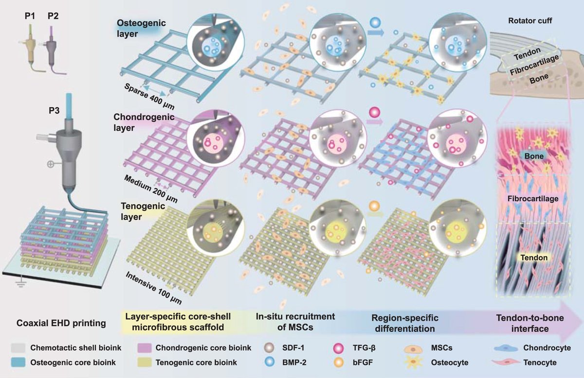 IntJExtremManuf's tweet image. #Coaxial #electrohydrodynamic printing of #coreshell #microfibrous scaffolds with layer-specific growth factors release for enthesis regeneration
#ExtremeManufacturing #growthfactors #EnthesisRegeneration

Open Access
doi.org/10.1088/2631-7…