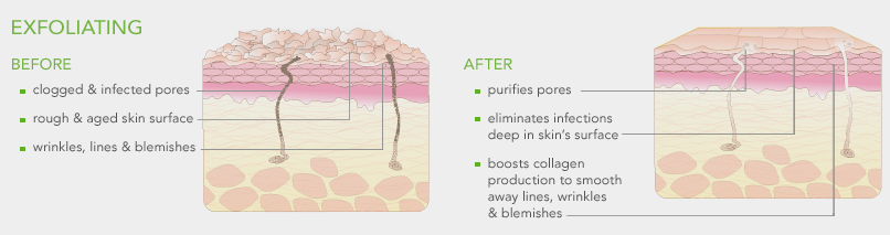 Sia sia jela kalau pakai skincare 10 step tapi tak include exfoliator dalam skincare routine.   

Tahu tak actually, kalau korang rajin exfoliate skin, products yang korang pakai tu jadi lagi effective?