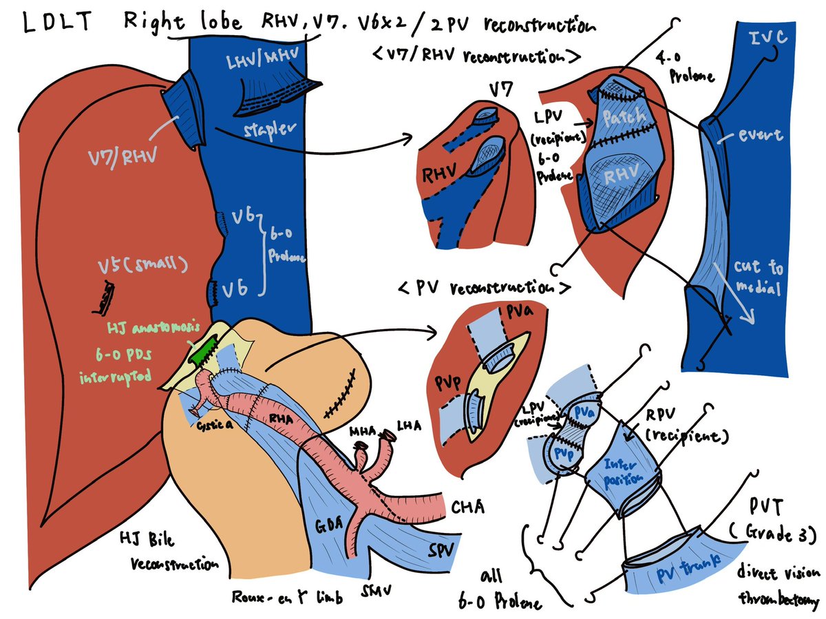 Toru Goto, MD tweet media