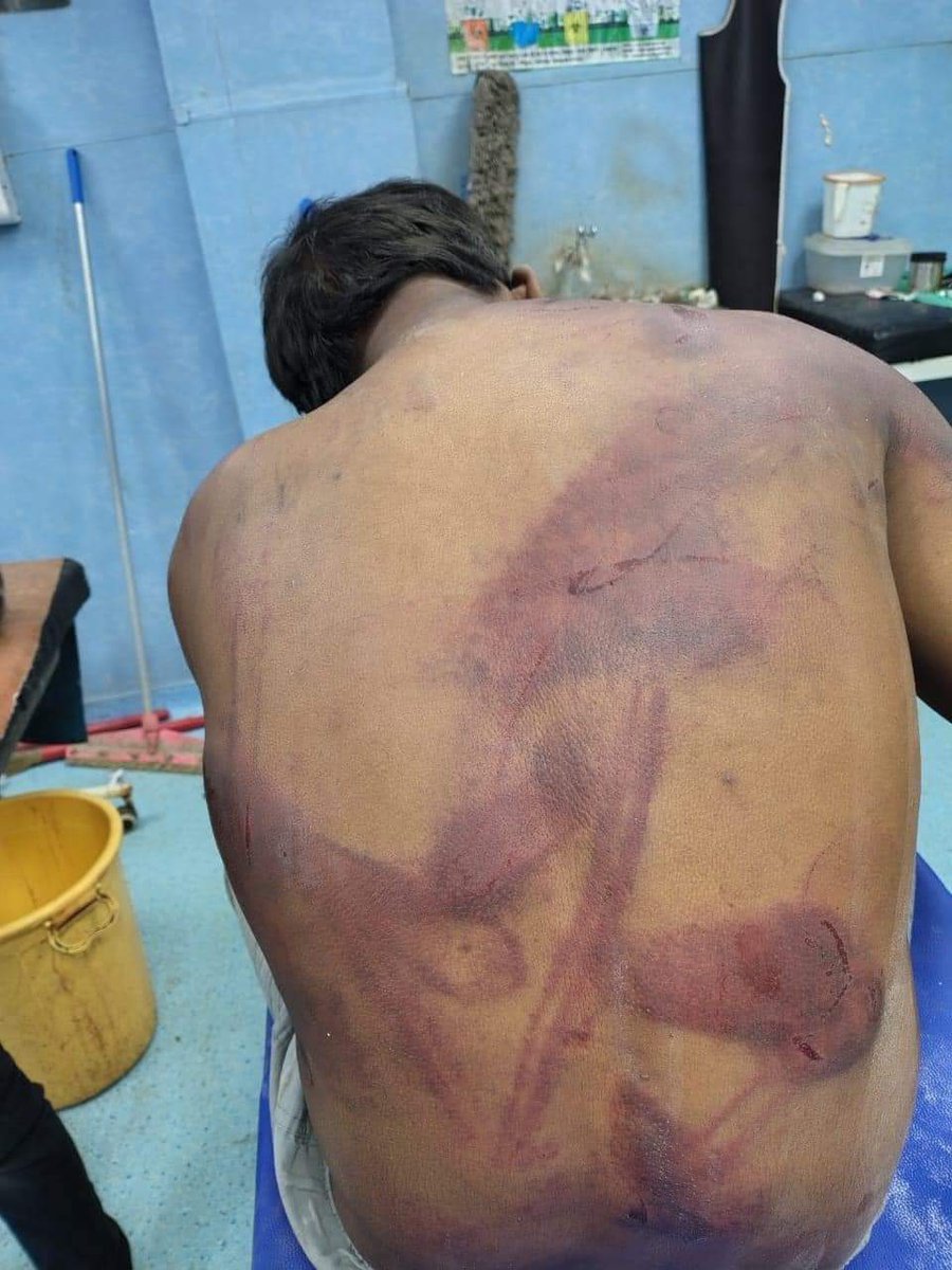 यह गैस्ट्रो लिवर अस्पताल गोरखपुर में बुरी तरह मार खाए <a href="/Uppolice/">UP POLICE</a> सिपाही पंकज की मेडिकल के समय की फोटो बताई गई है. डॉक्टर का FIR दर्ज कर पंकज को जेल, पर दवाब में पंकज की पिटाई पर कोई कार्यवाही नहीं.

यदि तत्काल FIR नहीं तो कैंट थाने पर अनिश्चितकालीन विरोध

<a href="/dgpup/">DGP UP</a> 
<a href="/gorakhpurpolice/">Gorakhpur Police</a>