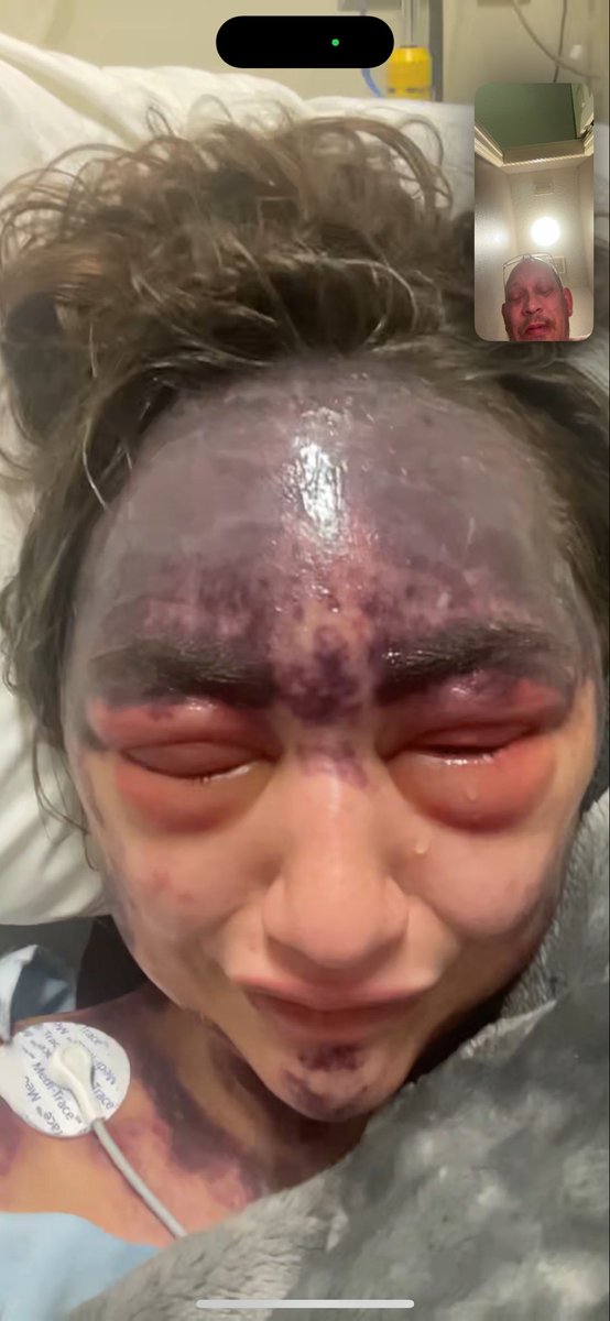 RealToddLorenze's tweet photo. Alexis Lorenze @llexxiiiiiiii was yelled at by hospital staff, for trying to wash her self in the room sink, she had no toilet and had to pee in a bucket that Samantha found. All requests for medical attention were denied.  Even a cup of water took 6 hours. https://t.co/8au55gm81N
