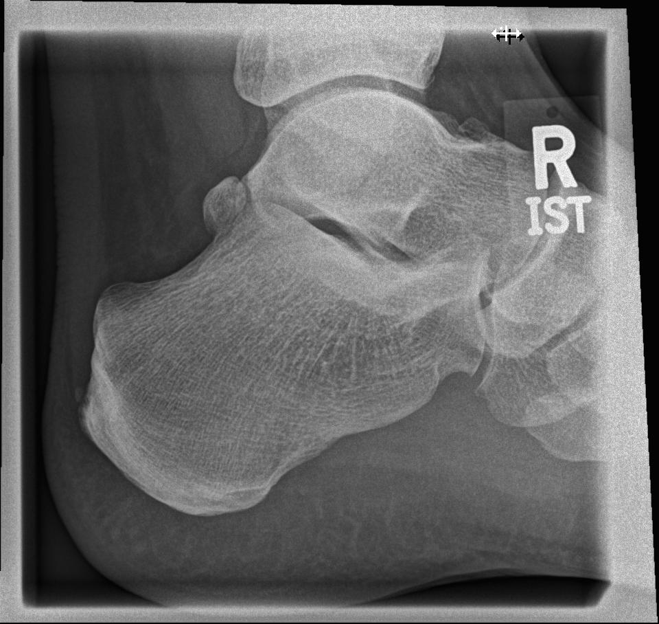 SweetSlushGames's tweet photo. That's it, I'm showing my feet for engagement.
(this is actually my foot) https://t.co/yJ8TrTnrHd